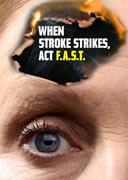 NHS Somerset Drives Stroke and Wasted Medicines Awareness Campaigns